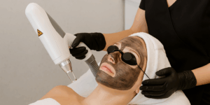 How to Prepare for Your First Carbon Facial in Christchurch, New Zealand